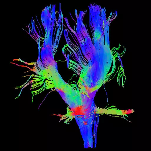do-not-clone-advanced-visualization-applications-brain-view-plus-aw-brainview_overview.jpg