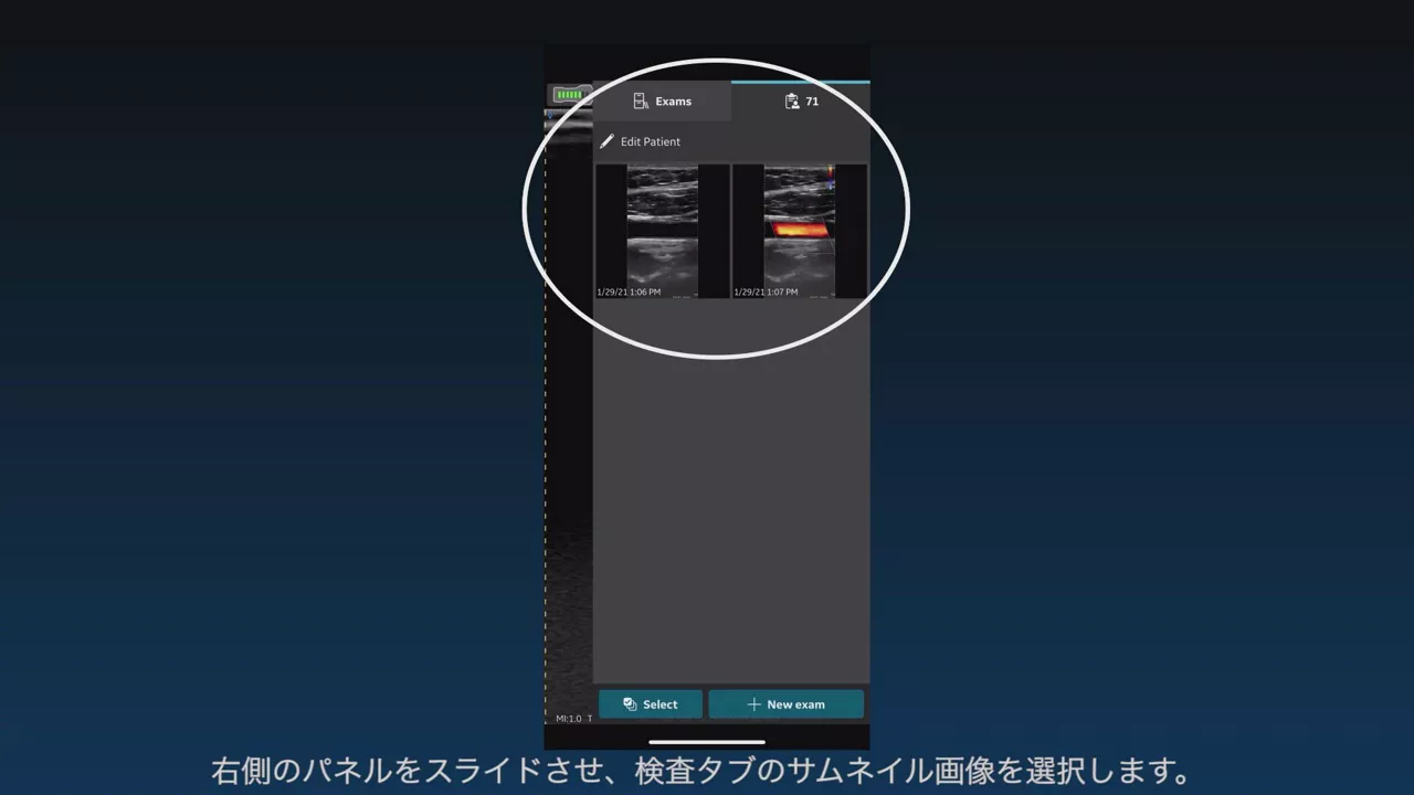 Vscan Air Details | GE HealthCare (Japan)
