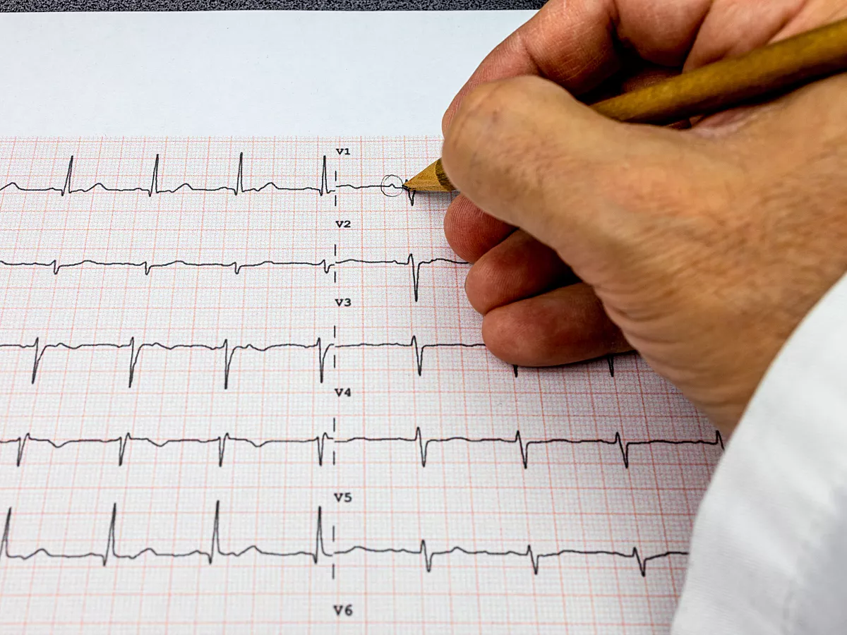 doctor-analyzes-an-ecg-1