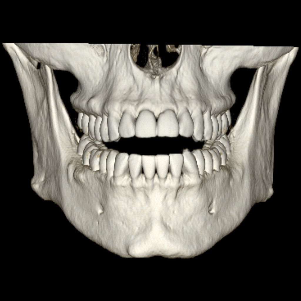 donotcloneadvancedvisualizationapplicationsdentascanplusawdentascanoverviewjpg