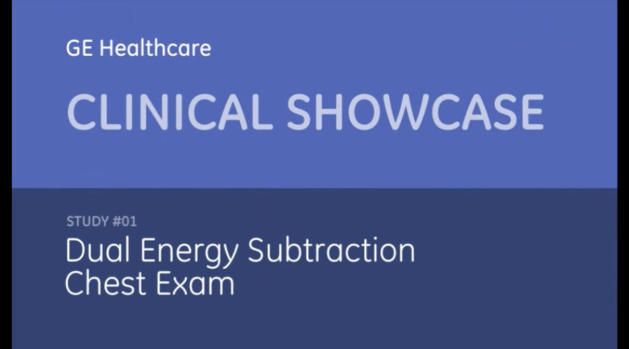 Dual-Energy-Subtraction-Chest-Exam
