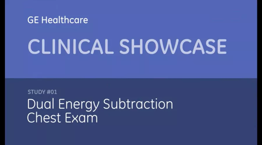Dual-Energy-Subtraction-Chest-Exam