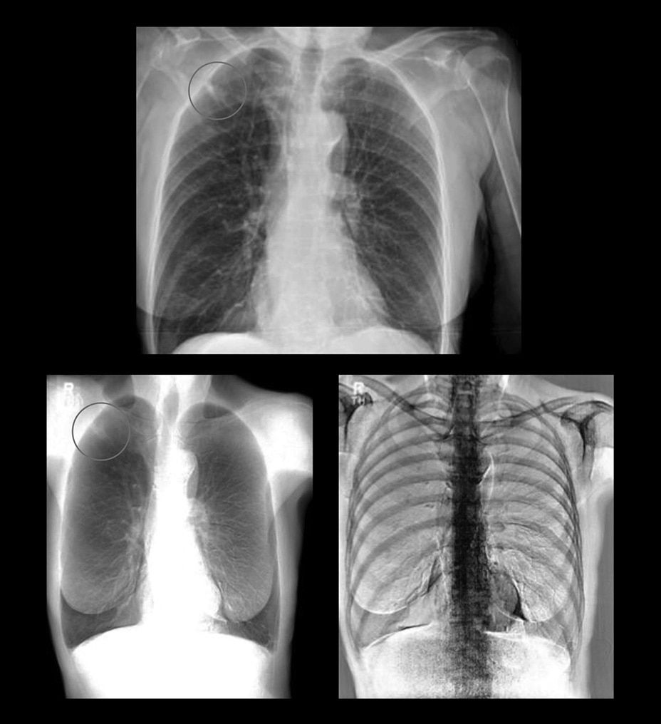 dual-energy-subtraction-feature-hero-consistent-st-en