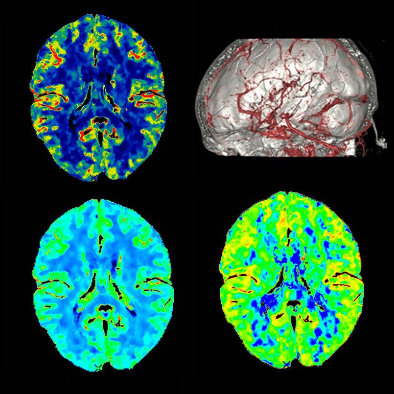 duct-categories-computed-tomography-revolution ct-clinical images-neurology-wholebrain.jpg