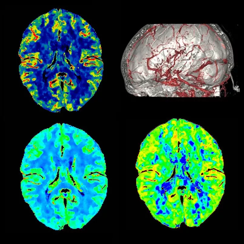 duct-categories-computed-tomography-revolution ct-clinical images-neurology-wholebrain.jpg