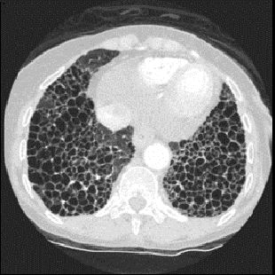 duct-categories-computed-tomography-revolution ct-image gallery-bottom right image new.png