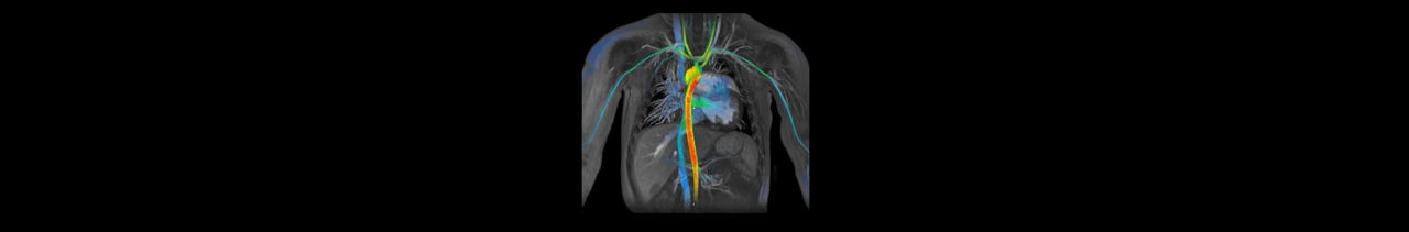duct-ultrasound-signaarchitect-clinicalimages-viosworks-viosworks