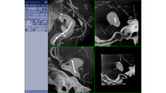 dvanced-visualization-applications-innova-ct-hd-clinical-ge-awinnovacthd-enterprise