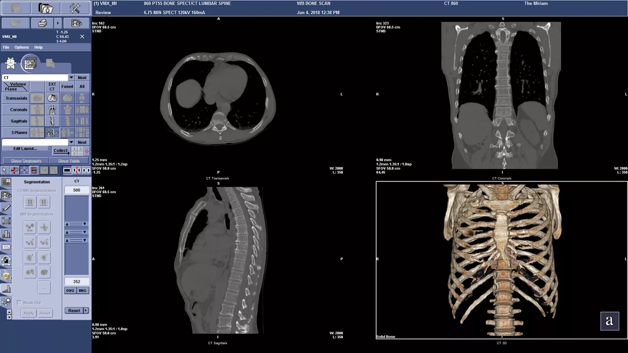 Dx CT 860