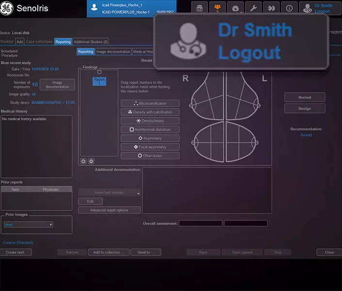 Dynamic-Column-Callout-Workflow1
