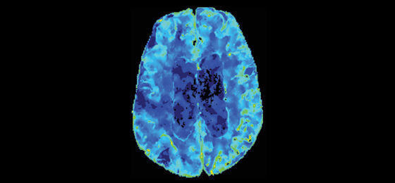 Dynamic perfusion1 560x260