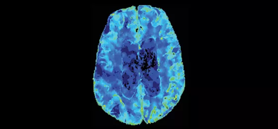 Dynamic perfusion1 560x260