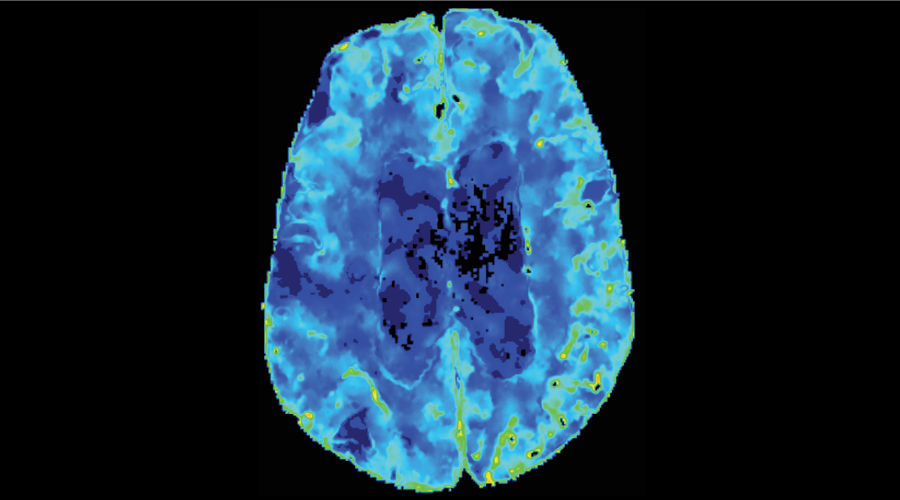 Dynamic perfusion1_900x500