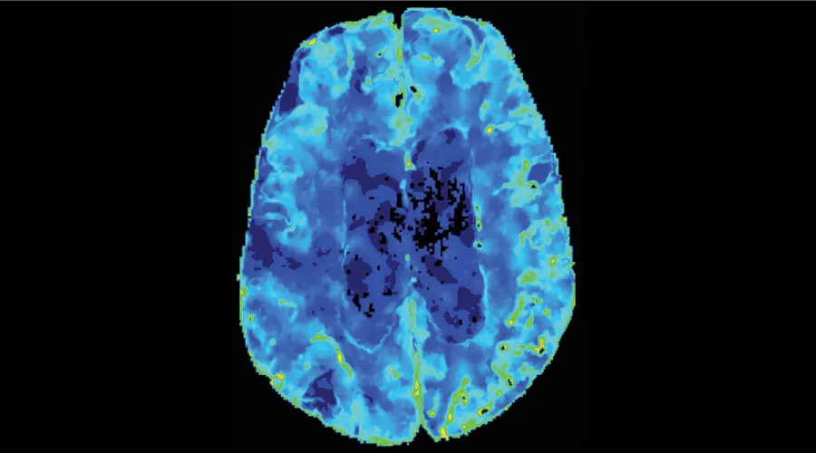 Dynamic perfusion1_900x500