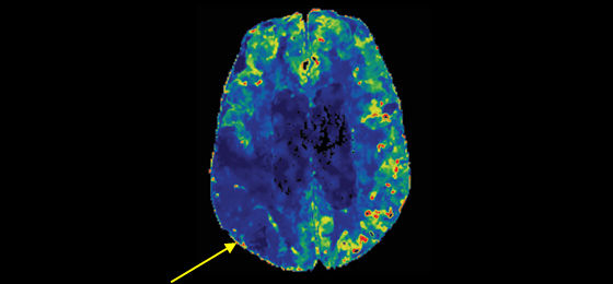 Dynamic perfusion2 560x260