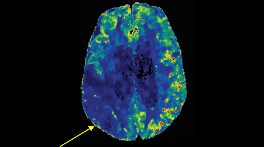 Dynamic perfusion2_900x500