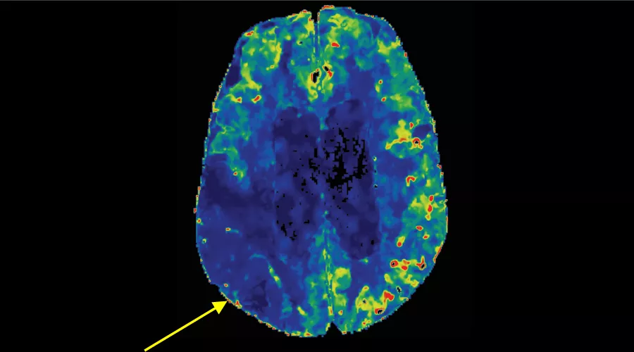 Dynamic perfusion2_900x500