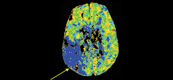 Dynamic perfusion3 560x260