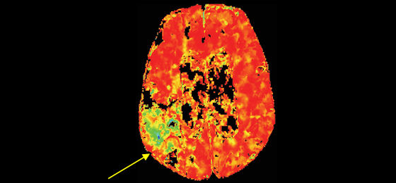 Dynamic perfusion4 560x260