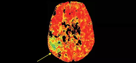 Dynamic perfusion4 560x260
