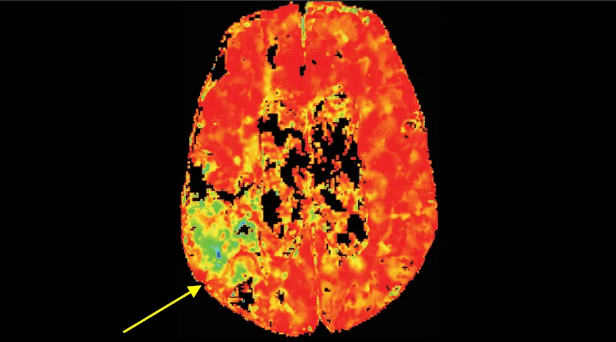 Dynamic perfusion4_900x500