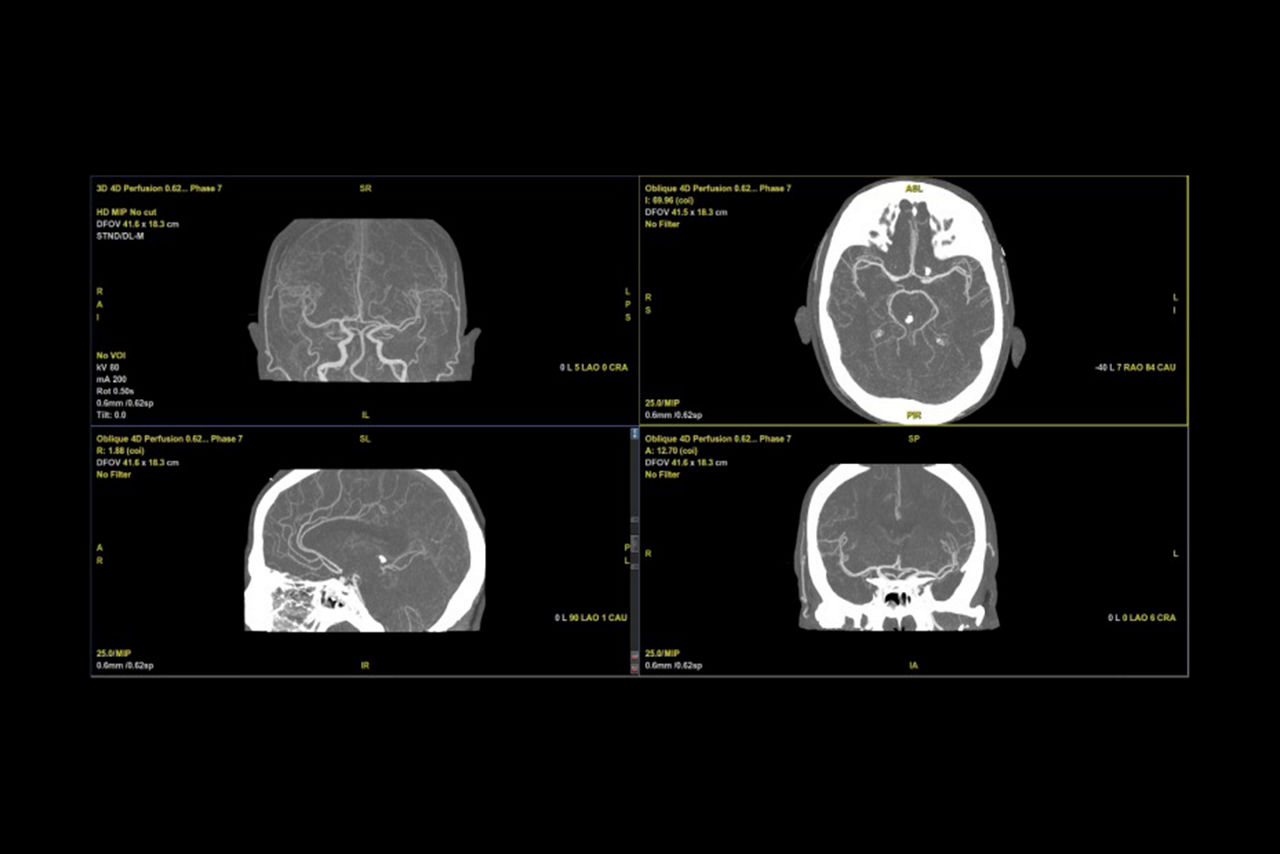 dynamic-shuttle-bone-free-dynamic-visualization-desktopnew