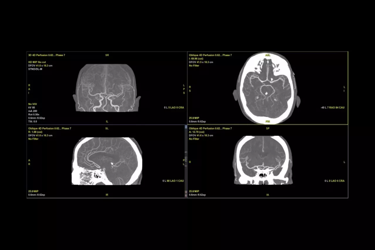 clinical bone image
