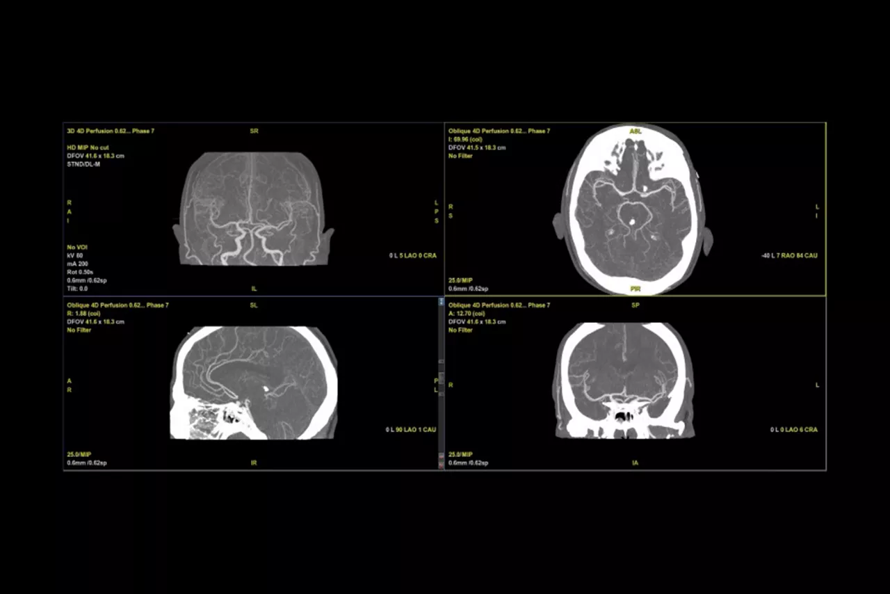 dynamic-shuttle-bone-free-dynamic-visualization-desktopnew
