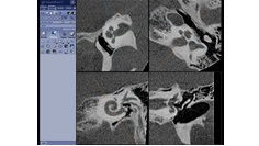 e-advanced-visualization-applications-innova-ct-hd-clinical-ge-awinnovacthd-cochlea