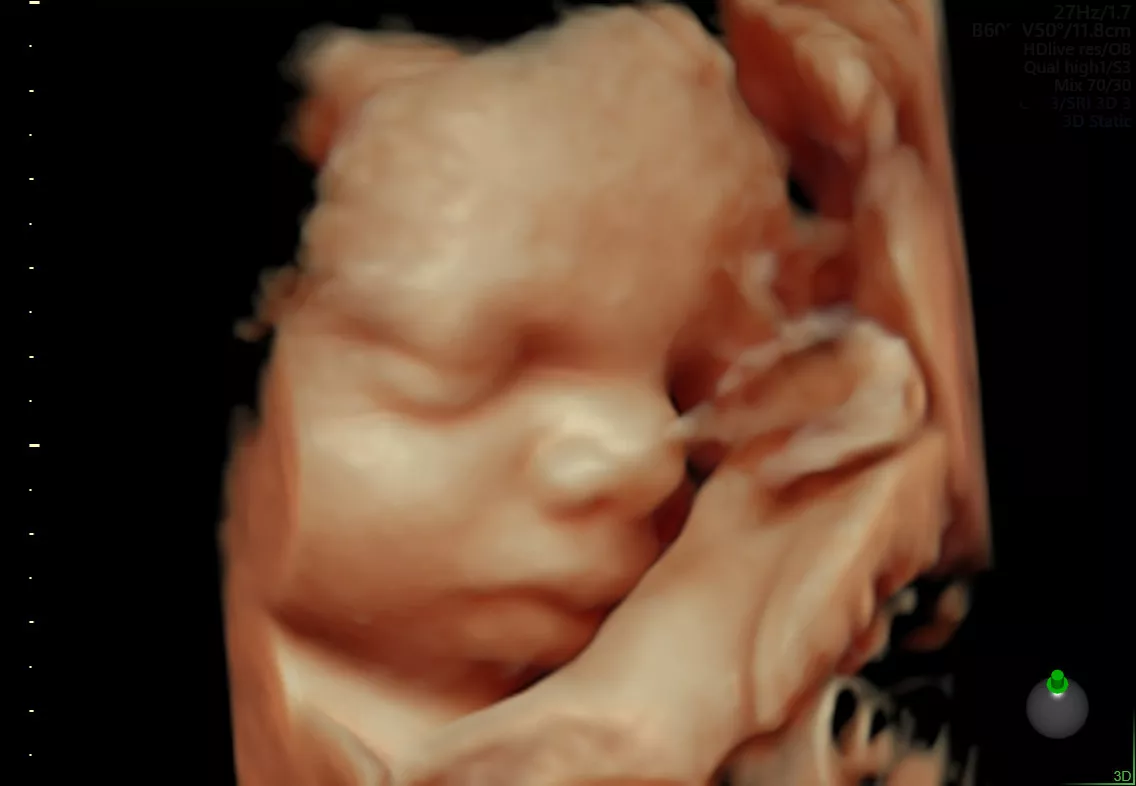 E6 Gallery Fetal Face