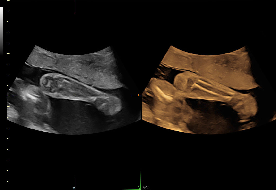 E6 Volume Contrast