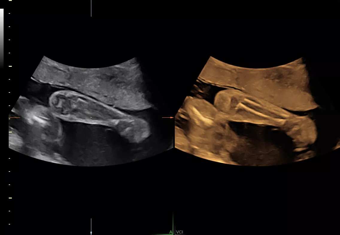 E6 Volume Contrast