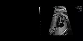 cq5dam.thumbnail.319.319