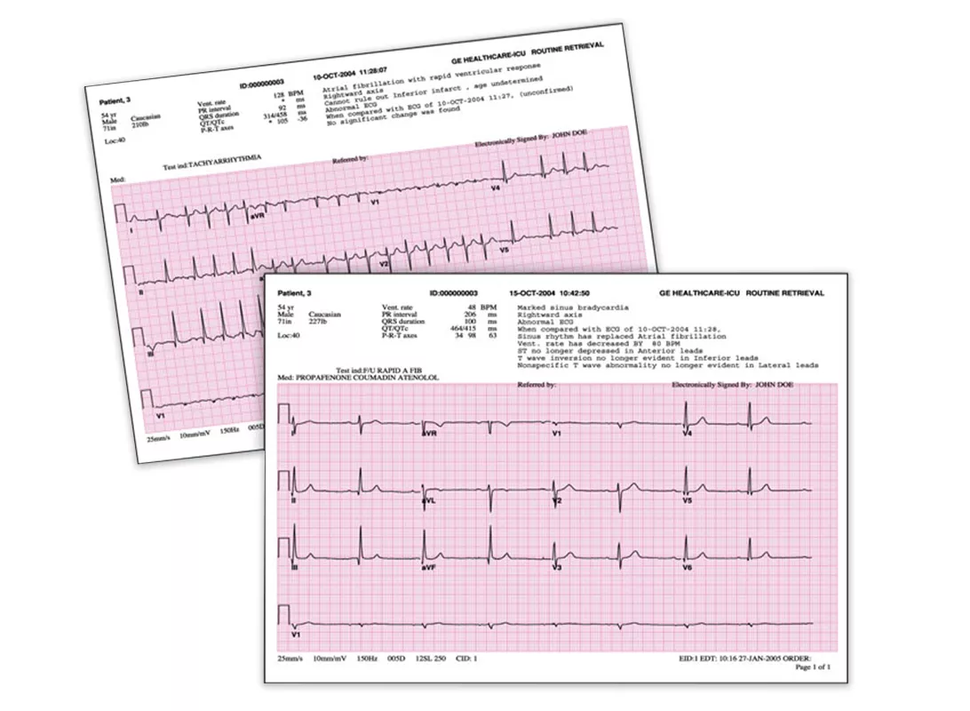 ECG Analysis Sheets