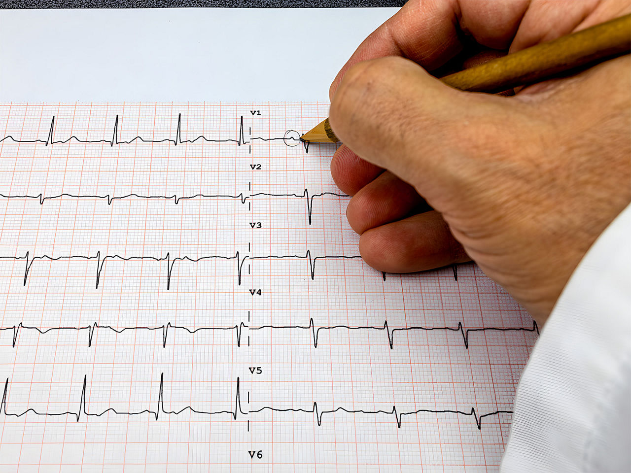 ecg-for-everyone-ArticleHero-ci-en