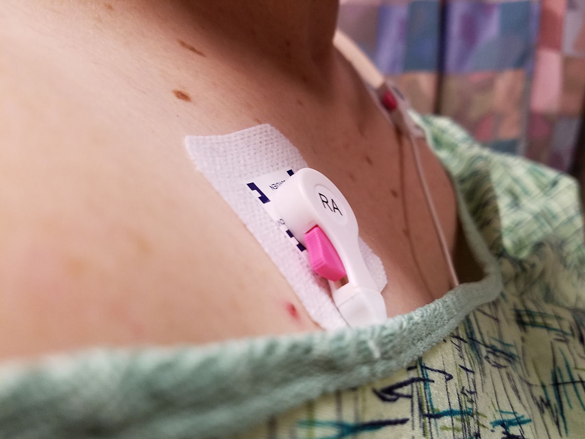 ecg-leads-patient-hospit