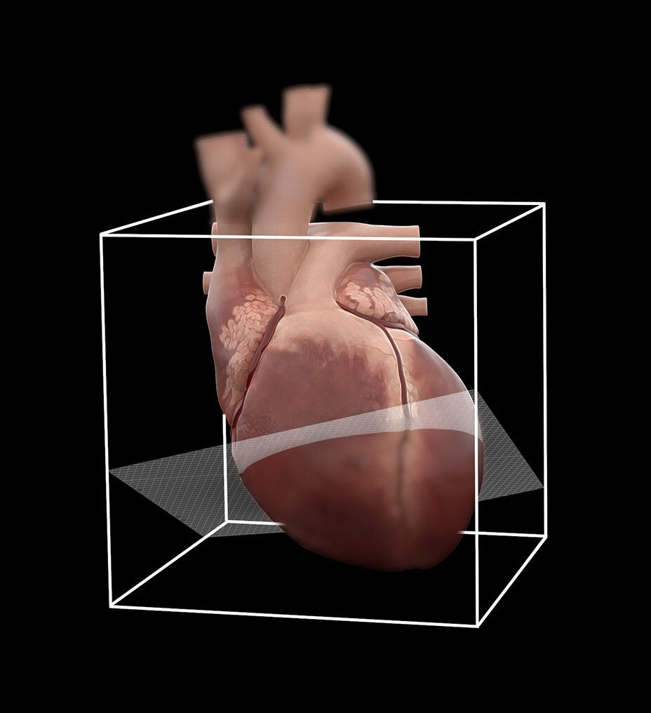 ecg-less-cardiac-ct-4-ci-en