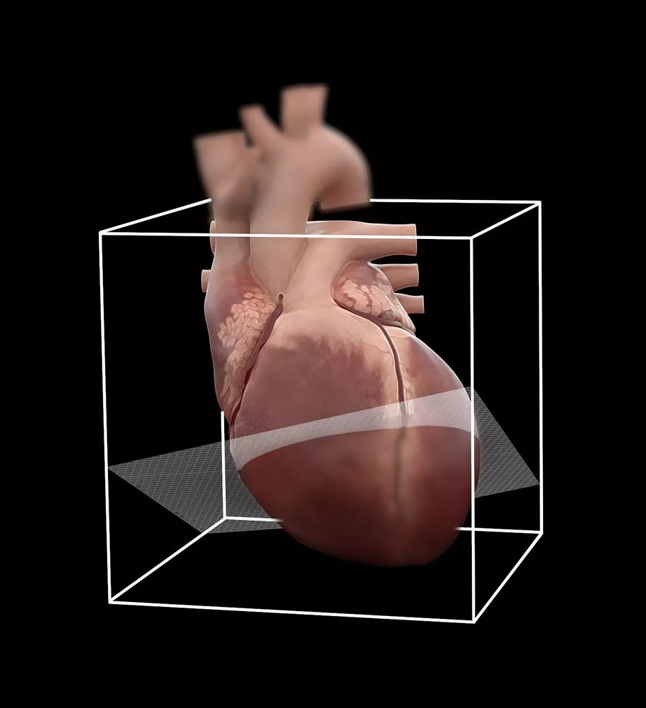 ecg-less-cardiac-ct-4-ci-en