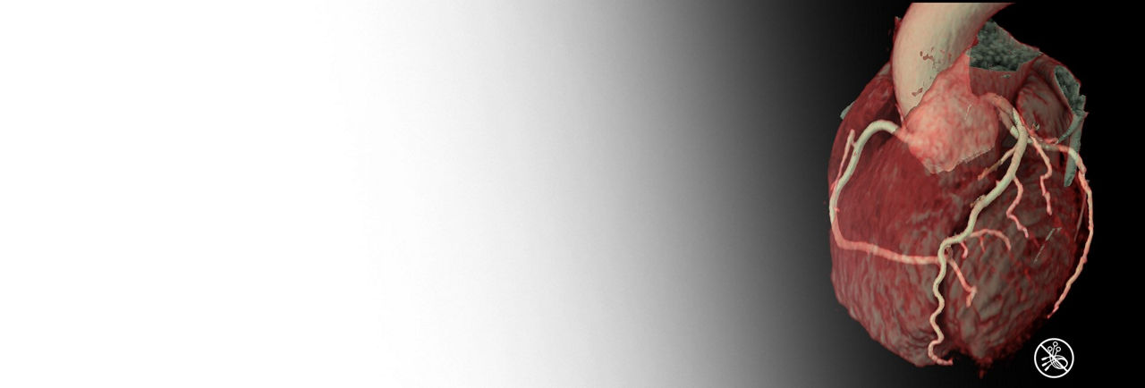 ecg-less-cardiac-ct-ba-en