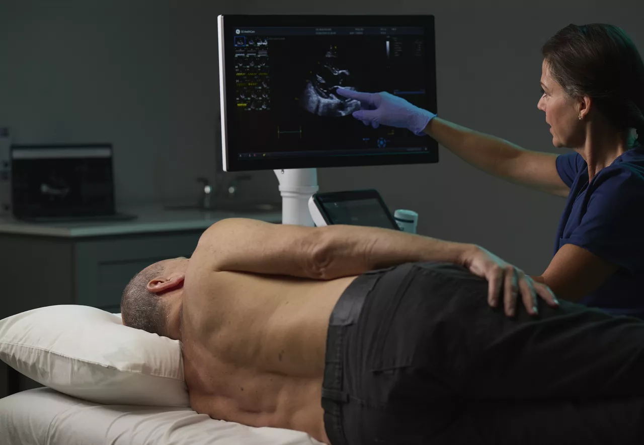 echocardiography-ai-reducing