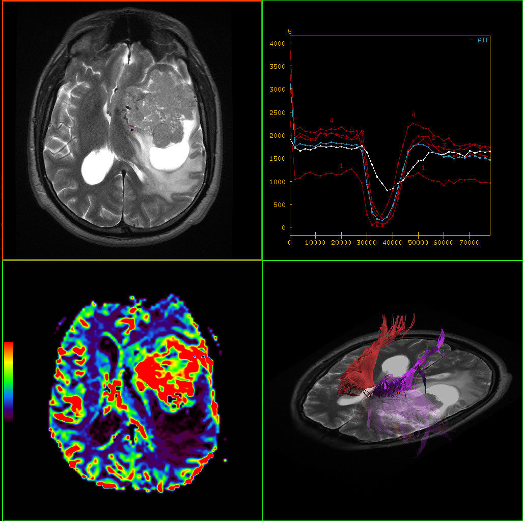 ed-visualization-applications-readyview-aw-readyview-clinical-image-multi-parametric2
