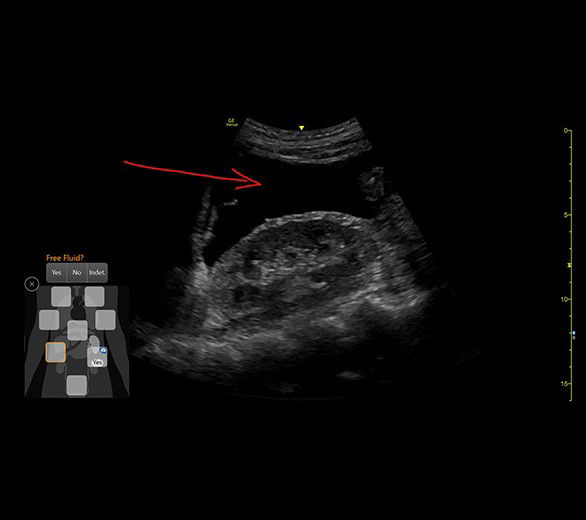 efast-diagram-withscribble-desktop 1