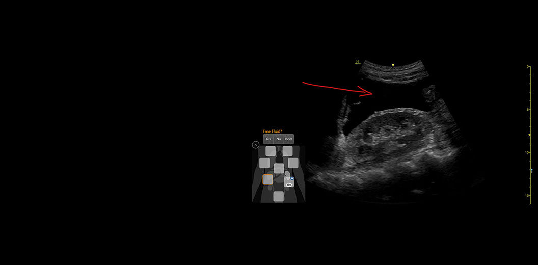 eFAST-Diagram-withscribble-desktop