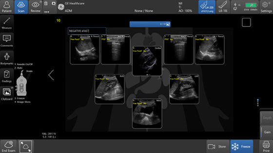 eFAST-Diagram_560wide