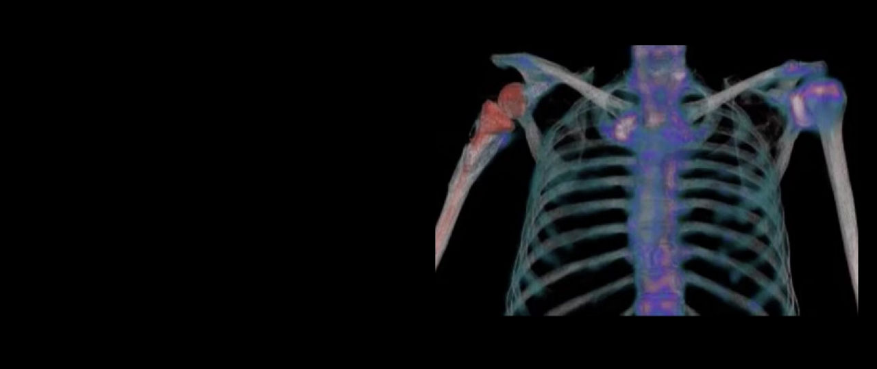 effortlessimaging-hero-ba-en