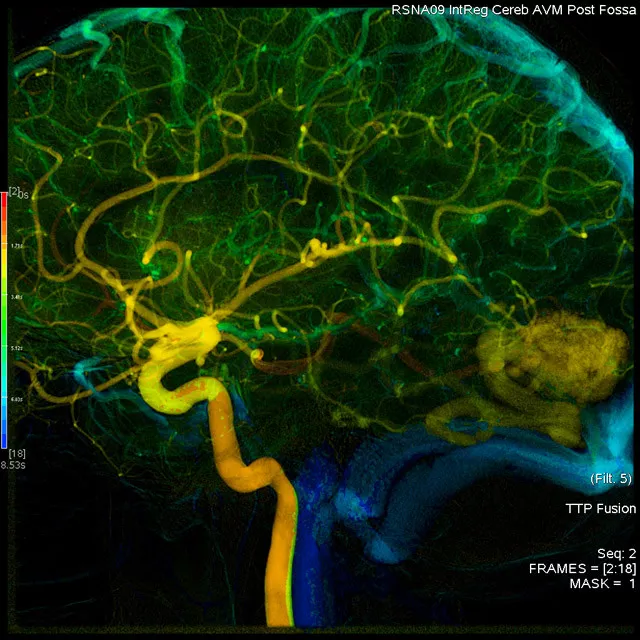 egories-do-not-clone-advanced-visualization-applications-angioviz-aw-angioviz-overview.jpg