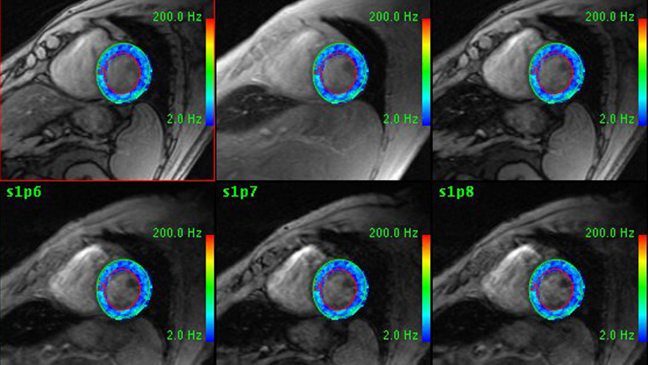 visualização avançada cardiacvx.