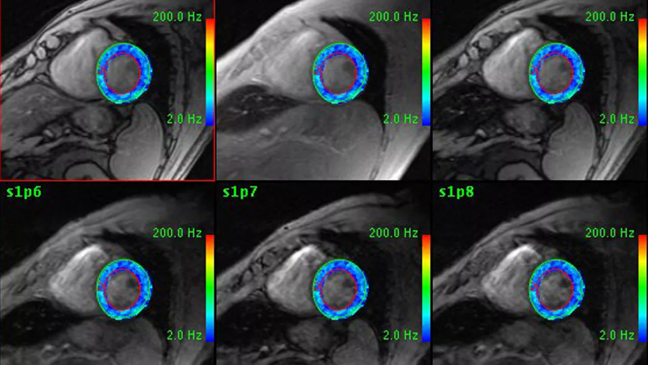 cardiacVX para una visualización avanzada.