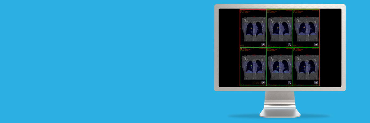egories-do-not-clone-advanced-visualization-applications-motionvue-spotlight-motionvue.jpg