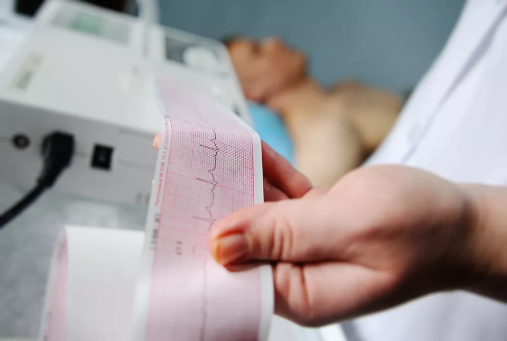 electrocardiogram-ecg-in